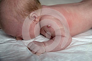 Vaccine for tuberculosis disease on newborn baby