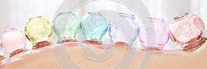 Vacuum cupping therapy. Close up detail of glass suction cups applied to patient`s back. Web banner. photo