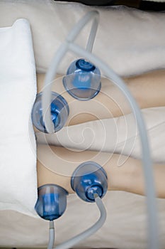 Vacuum massage with a blue vacuum-roller manipulator. Massage of the hips.