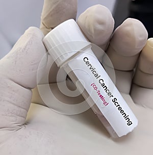 Vaginal fluid sample for Cervical Cancer Screening (CO-Testing),