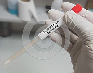 Vaginal fluid sample for Cervical Cancer Screening (CO-Testing), Human papilloma virus, cervical cancer.