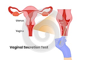 Vaginal secretion test. Vaginal swab vecor illustration