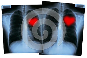 Valentines X-Rays - img