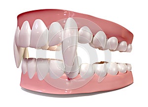 Vampire False Teeth Set Isolated