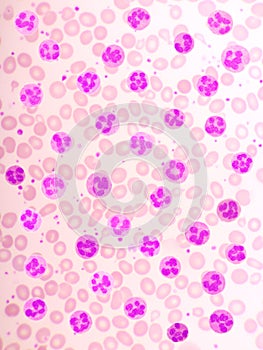 Variation of normal neutrophil cells or PMN cells in blood smear