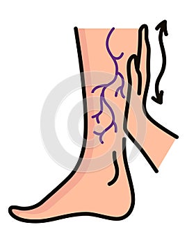 Varicose treatment icon. Violation of circulatory system. Vascular disease diagnostic. Venous insufficiency medical