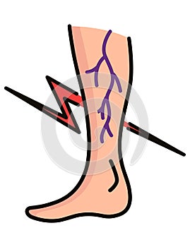 Varicose treatment icon. Violation of circulatory system. Vascular disease diagnostic. Venous insufficiency medical