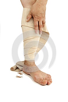 Varicose veins and bandage