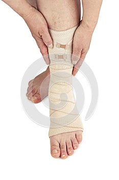 Varicose veins and bandage
