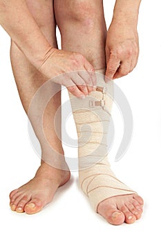 Varicose veins and bandage