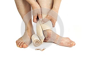 Varicose veins and bandage