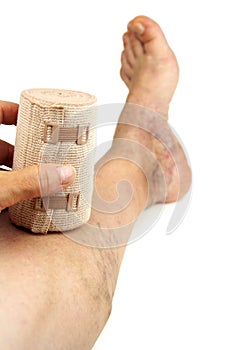 Varicose veins and bandage