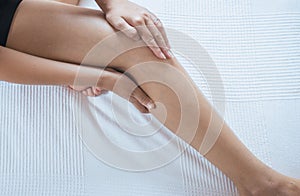 Varicose veins on the womans leg or foot,Body and health care concept