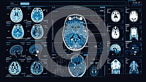 Computer Screen Displaying Multiple Brain Images
