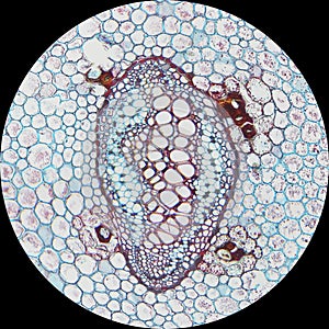 Vascular Bundle