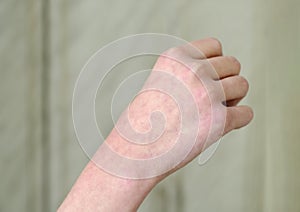 The vascular pattern is located on a person& x27;s arm or on his hand. Blood of person