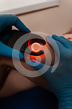 Vascular surgeon examines leg veins of woman using led venous scanner with red illumination. Venous led scanner for