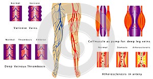 Vascular System Legs