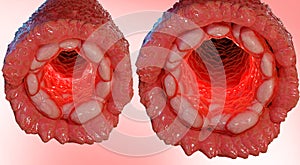 vasoconstriction and vasodilation blood pressure, dilated blood vessels or capillaries or artery photo