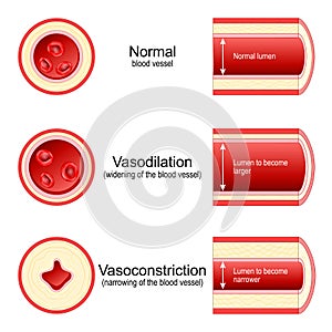 Vasoconstriction and Vasodilation photo