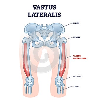 Vastus lateralis muscle location and hip or leg skeletal bone outline diagram photo