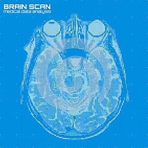 Vector blue abstract brain tomography analysis illustration. Digital brain x-ray scan.