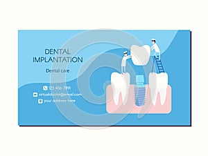 Vector dental implant dentistry business card design. Two implantologists place a dental implant: a crown is put on the