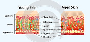 Vector diagram with schemes of two types of skin, for healthcare illustrations