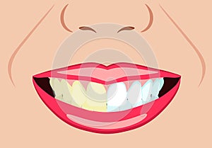 Vector face of girl and smile with bad and ideal teeth for dental and stomatological illustrations photo