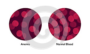Vector flat blood cell illustration. Red gradient erythrocytes in set of circle frames isolated on white background. Concept of
