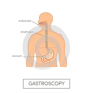 Vector gastroscopy concept