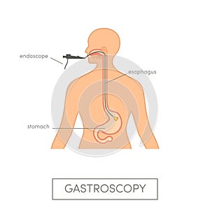 Vector gastroscopy concept