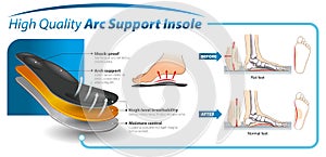 Infographic - insole