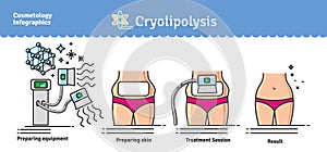 Vector Illustrated set with cosmetology Cryolipolysis treatment