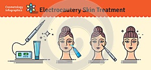 Vector Illustrated set with cosmetology electrocautery skin treatment