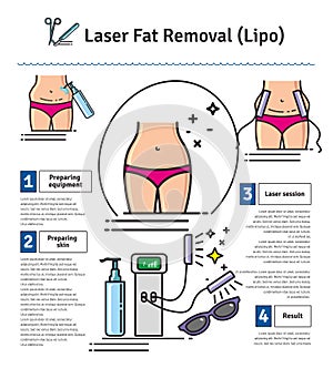 Vector Illustrated set with Laser LIPO Fat Removal