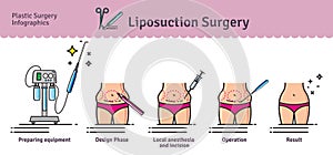 Vector Illustrated set with liposuction surgery photo