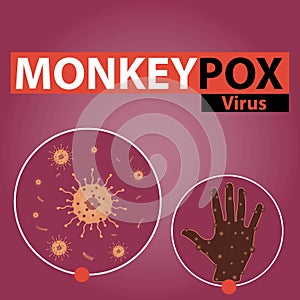 A vector illustration banner design for the monkey pox virus