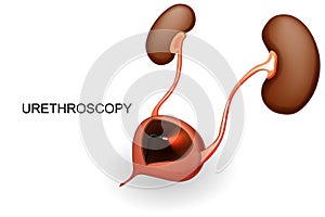 Bladder and kidneys. urethroscopy.