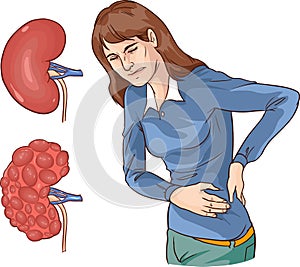 vector illustration of a Chronic kidney disease