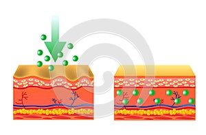 Vector illustration with cosmetic filler or Dermal fillers on light background