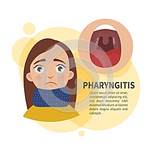 Pharyngitis infographics photo