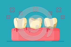 Vector illustration of dental diseases. The concept of inflamed teeth.