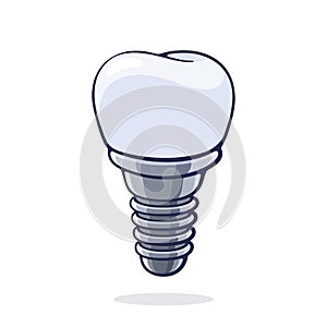 Vector illustration. Dental implant of human tooth. Fixture prothesis in dentistry. Symbol of somatology and oral hygiene