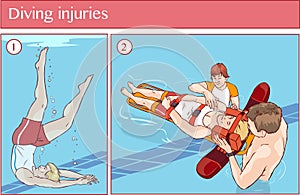 Vector illustration of a Diving injuries