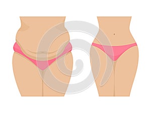 Vector illustration of a fat and thin female belly