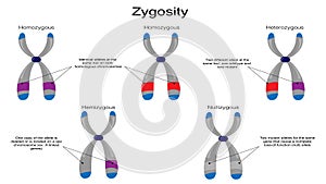 Vector Illustration Graphic of the Zygosity of Chromosomes