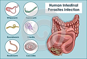 Vector Illustration of a Human Intestinal Parasites