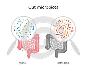 Vector illustration of human microbiota