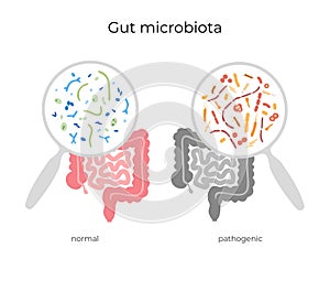 Vector illustration of human microbiota photo